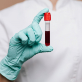 check up exame de sangue agendar Próximo a rua Doutor Franco da Rocha