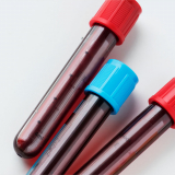 check up exame de sangue vila romero