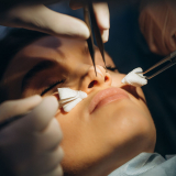 cirurgia plástica no nariz marcar vila romero