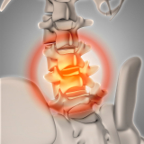 Médico Especialista em Coluna Lombar